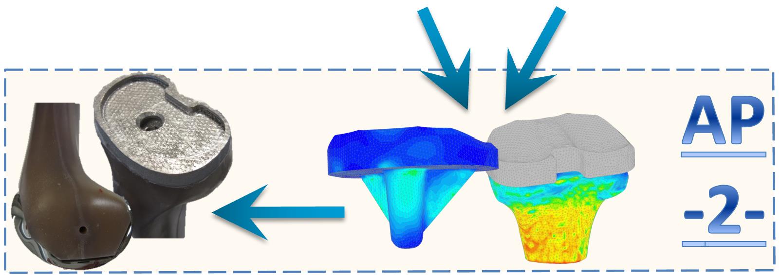 Biomechanical optimization and the manufactured individual knee implant