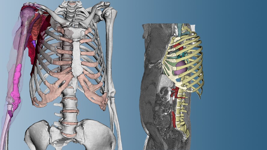 Dornheim Real Anatomy – real anatomy in 3D based on CT and MRI data